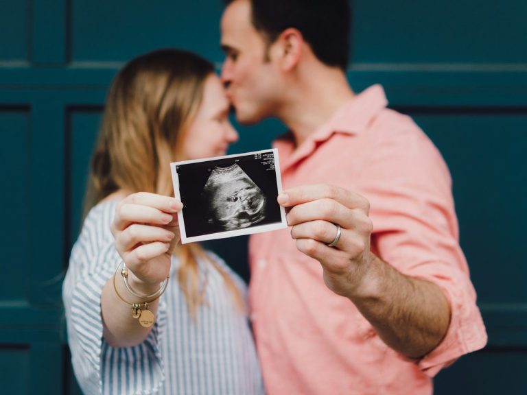 Paar hält Ultraschallbild eines Babys vor blauem Hintergrund.